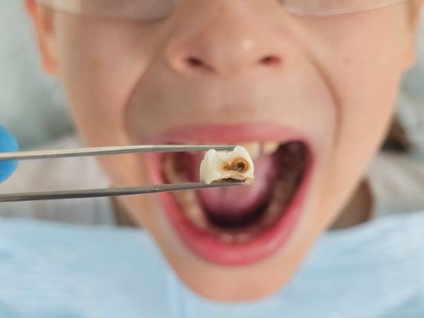 Best Cosmetic Emergency Dentistry in Onset, MA