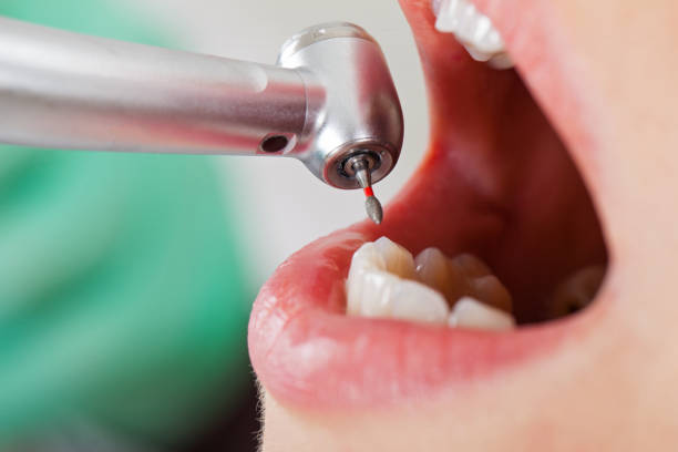 Best Cosmetic Emergency Dentistry in Onset, MA
